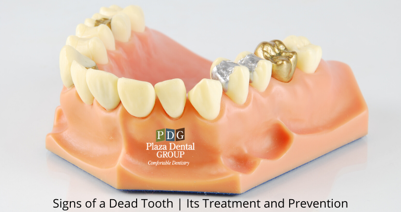 Signs of a Dead Tooth | Its Treatment and Prevention